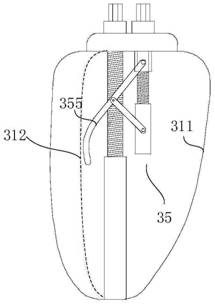 Heart valve adjustable auxiliary device and system