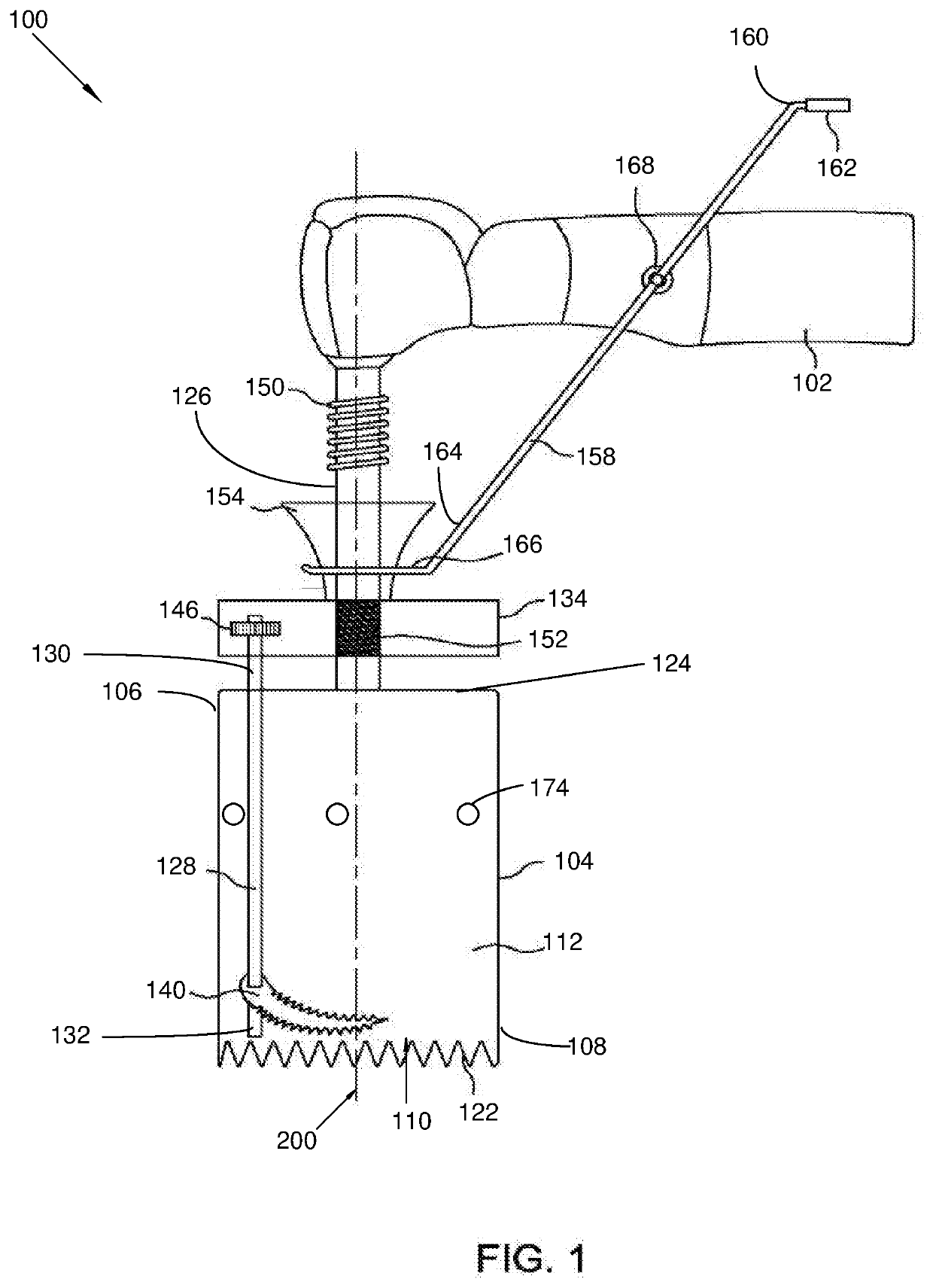 Device and method for autogenous bone grafting