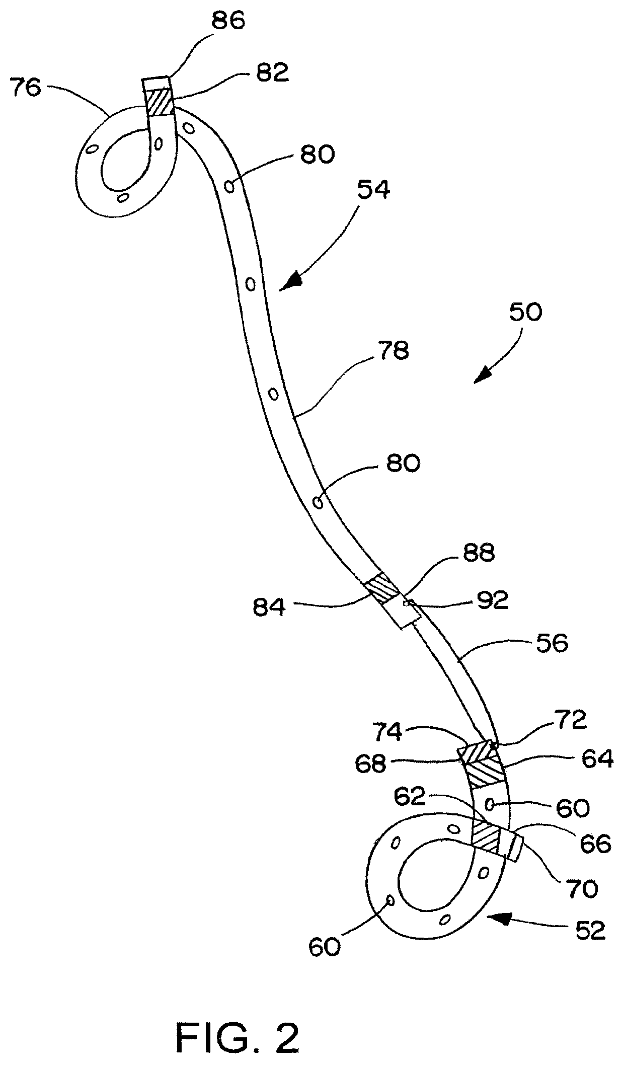 Ureteral stent for placement in a kidney and bladder