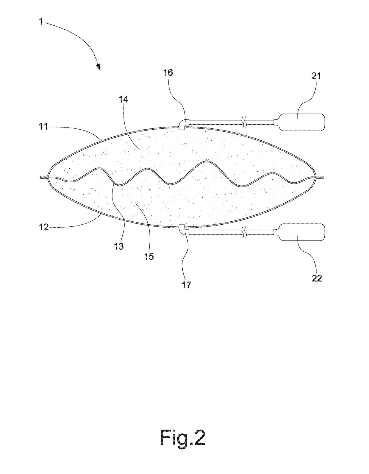 Air bag structure