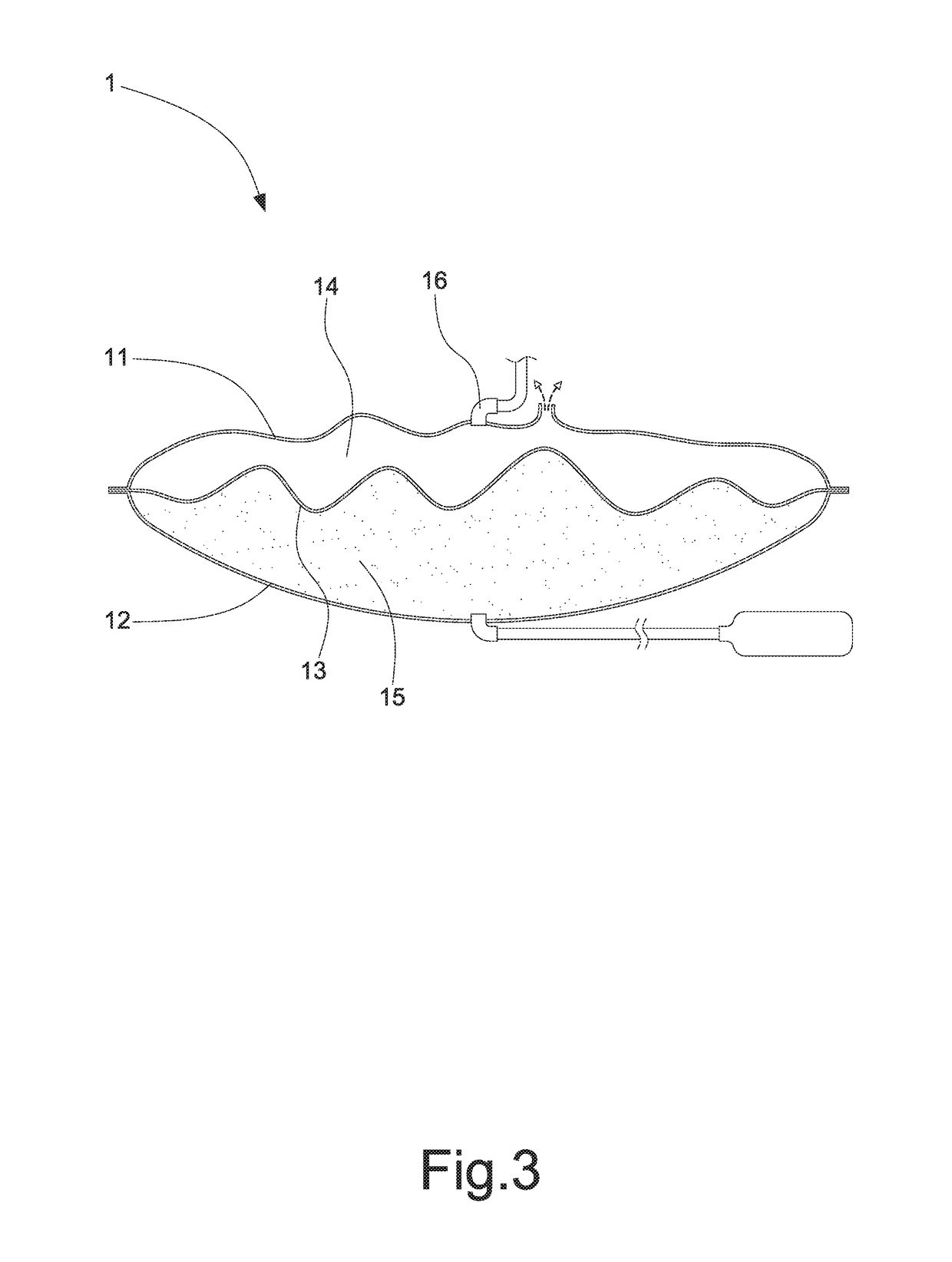 Air bag structure