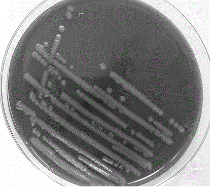 Avirulent Bacillus cereus strain pBC-1 and application thereof