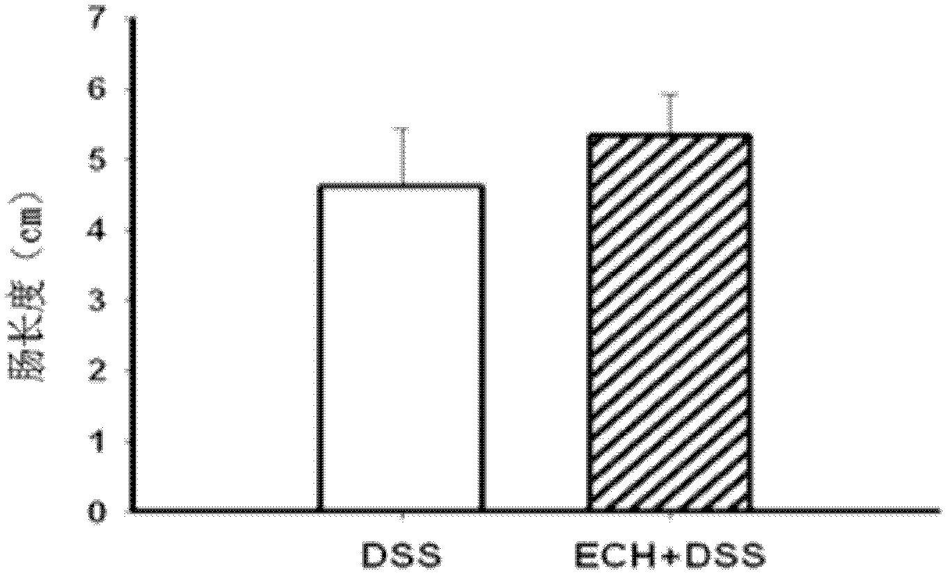 Application of echinacoside in preparation of medicine for treating inflammatory bowel disease