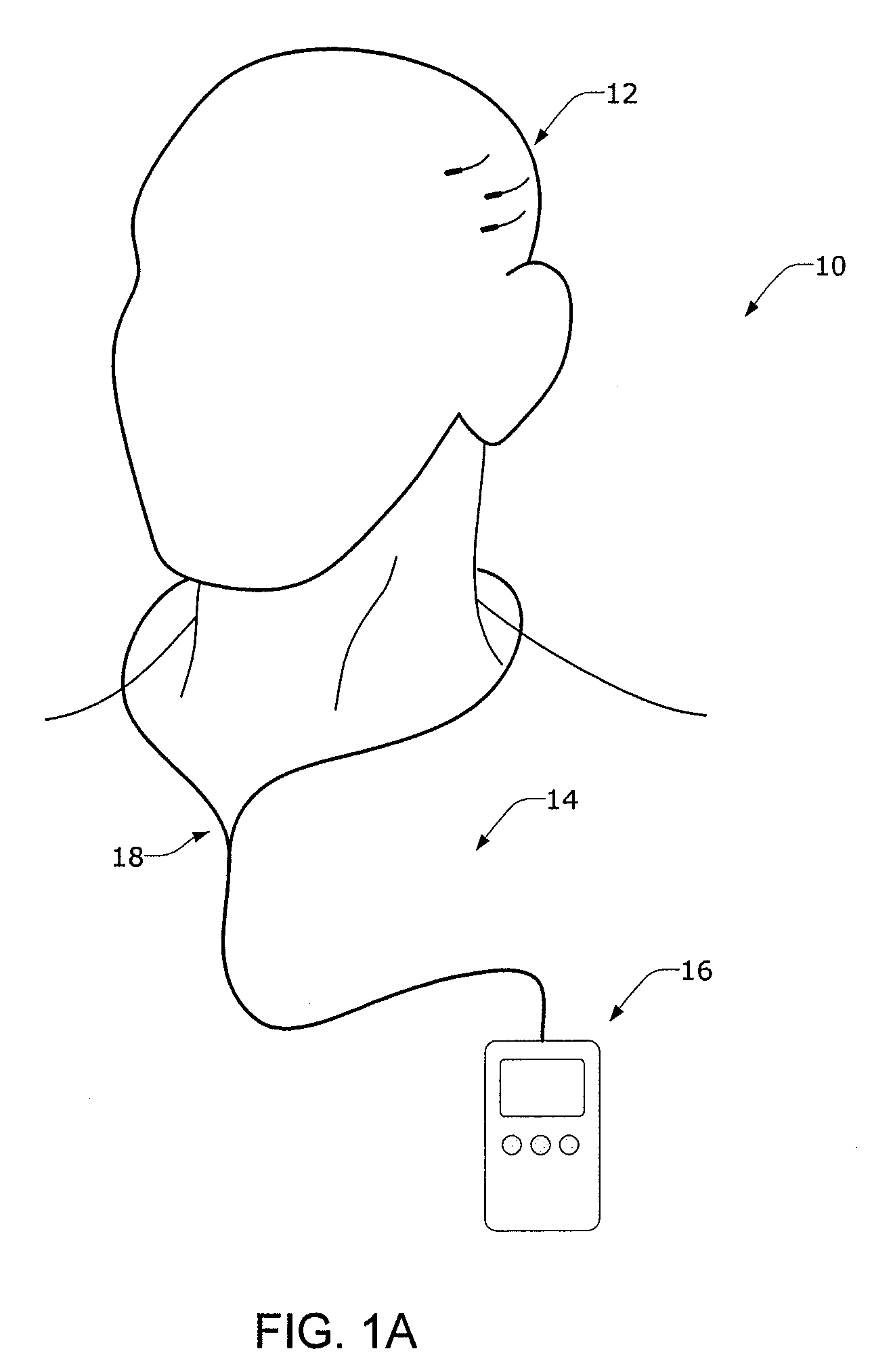 Minimally Invasive Monitoring Systems for Monitoring a Patient's Propensity for a Neurological Event