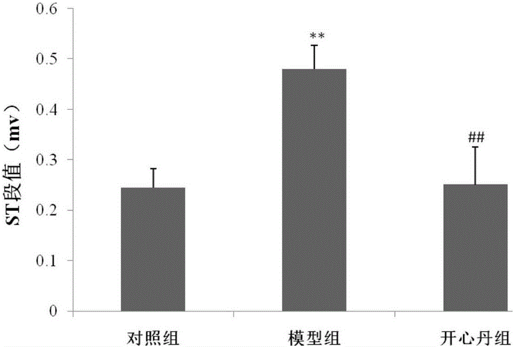 Pharmaceutical composition for preventing and treating myocardial ischemia and preparation method thereof