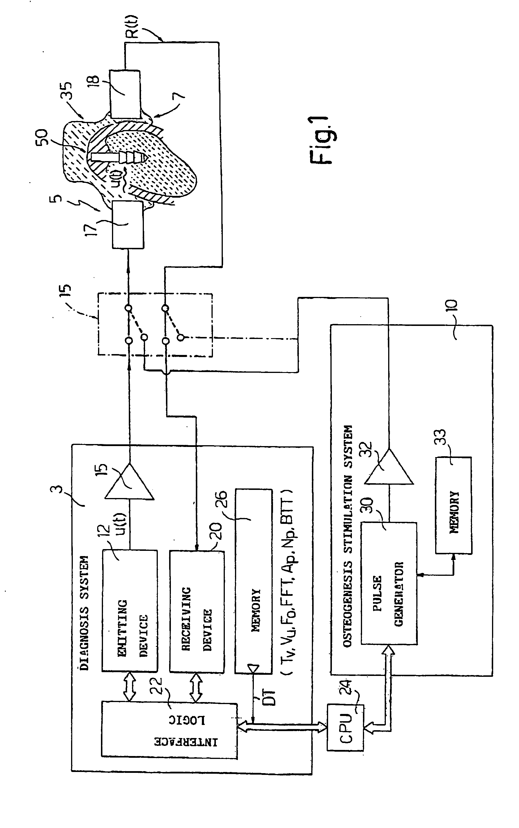 Electronic system for determining the density and structure of bone tissue and stimulating osteogenesis in dentistry