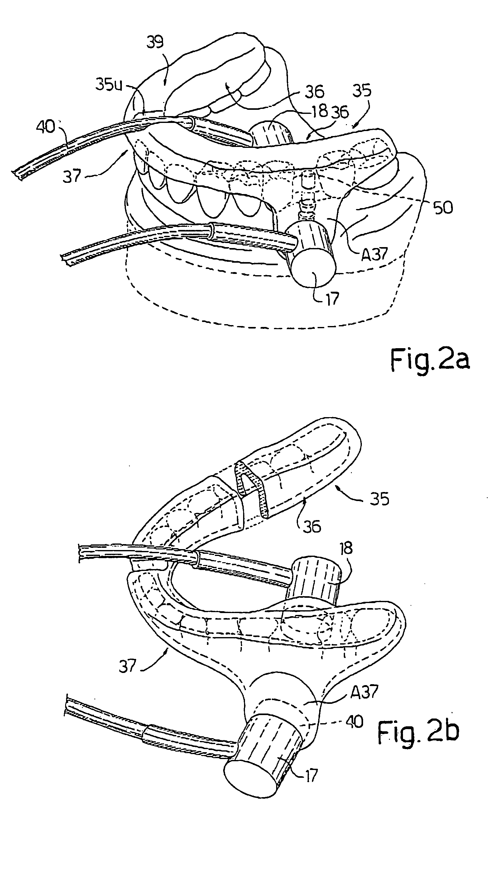 Electronic system for determining the density and structure of bone tissue and stimulating osteogenesis in dentistry