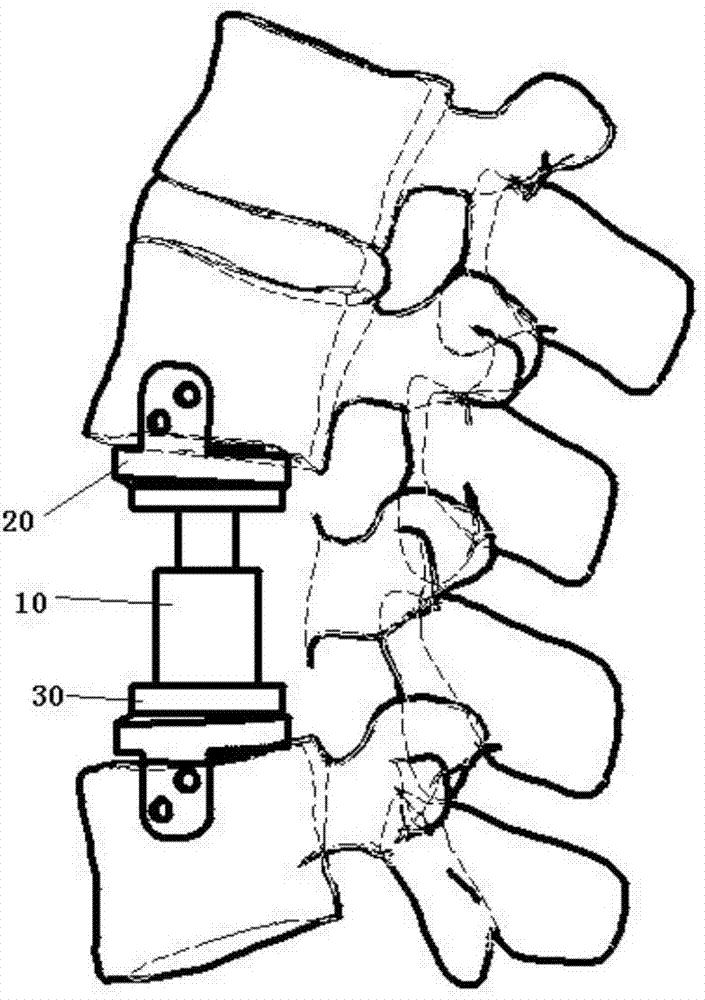 Artificial vertebra