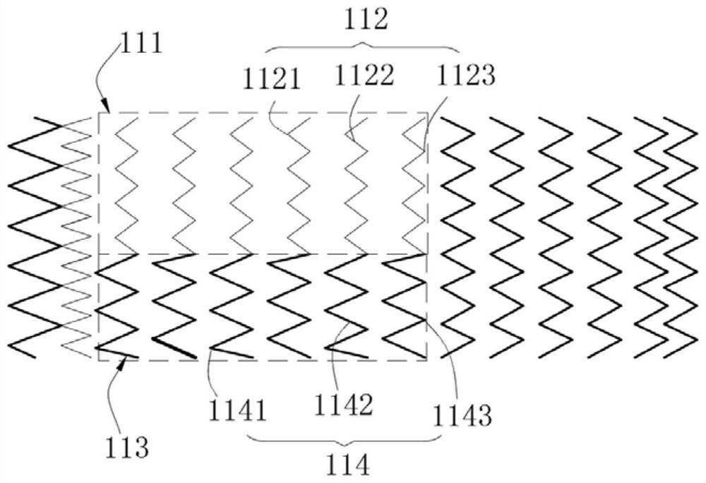 Stent Graft