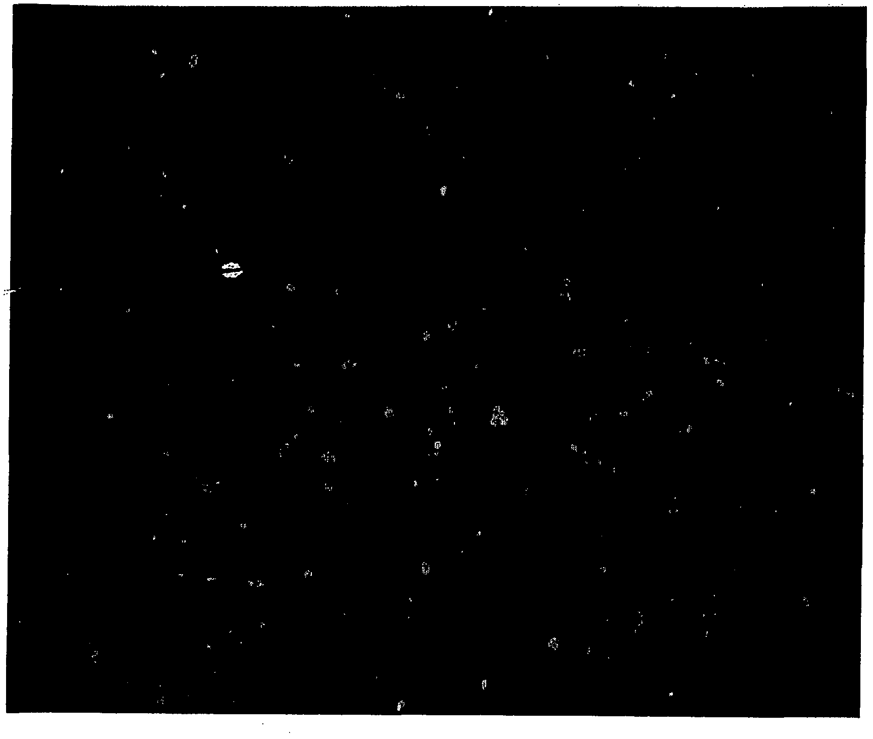 Direct fluorescene immunoassay for viral antigens