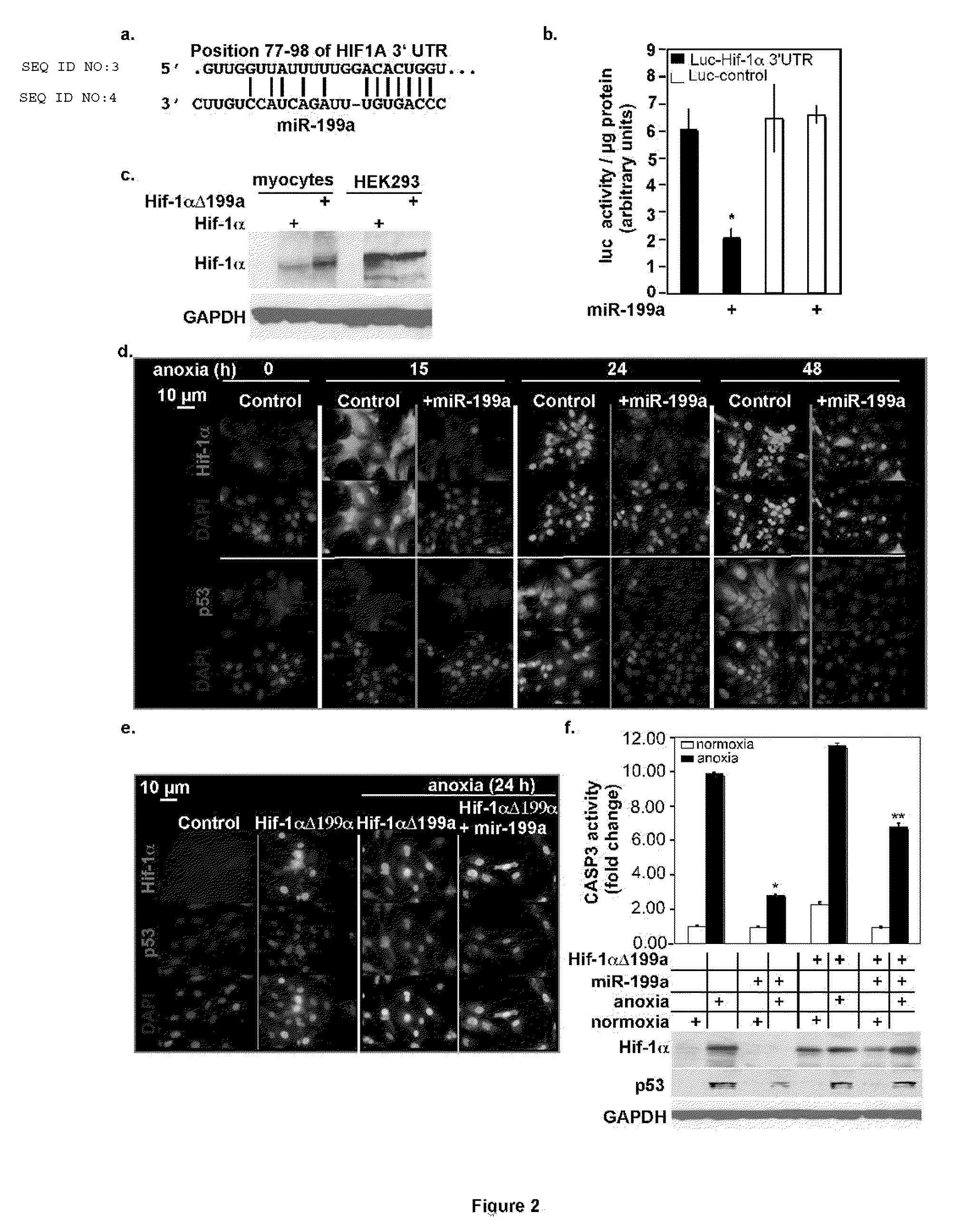 Anti-sense microrna expression vectors