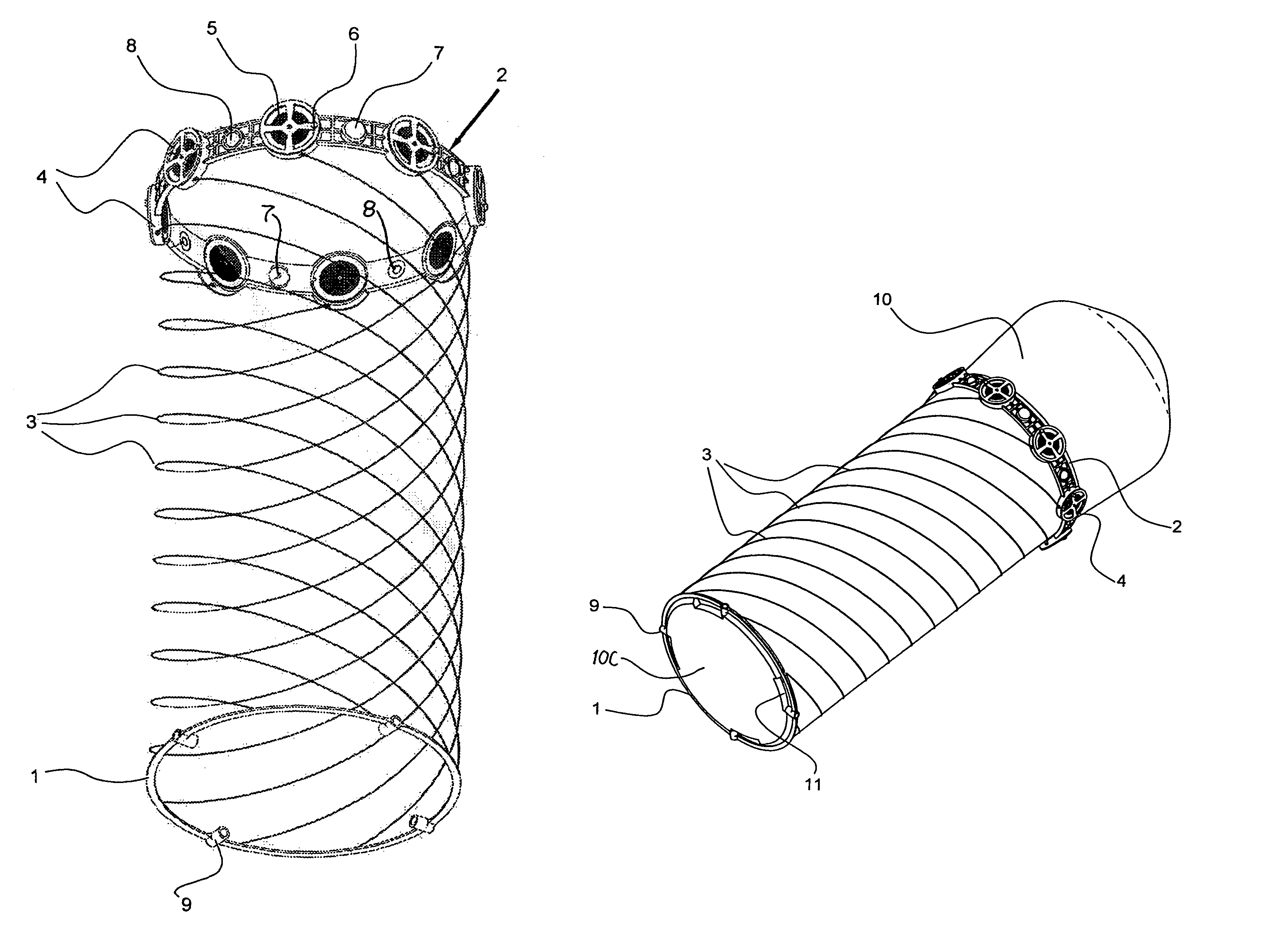 Apparatus with helical tension cables for ejecting a spin-stabilized body from a spacecraft