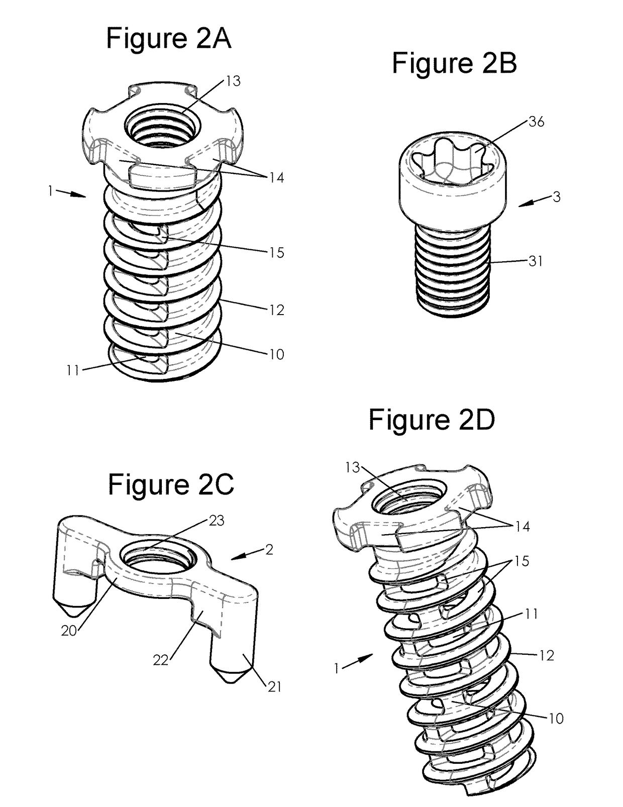 Bone implants