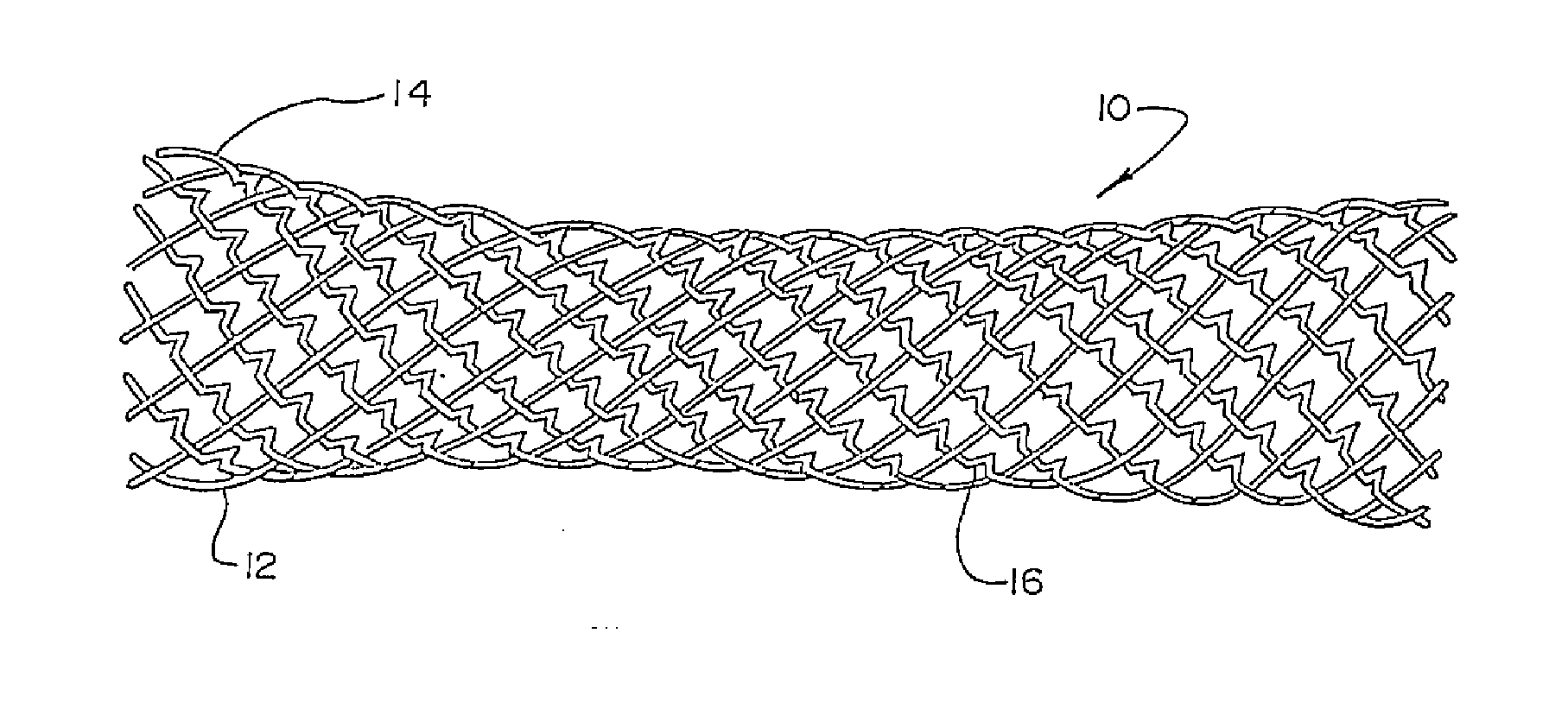 Improved tissue supporting devices