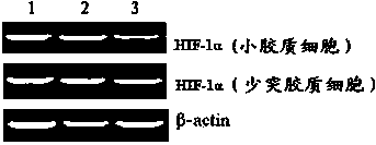 Targeting polypeptide-gene composite as well as preparation method and application of composite