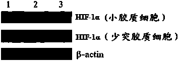 Targeting polypeptide-gene composite as well as preparation method and application of composite