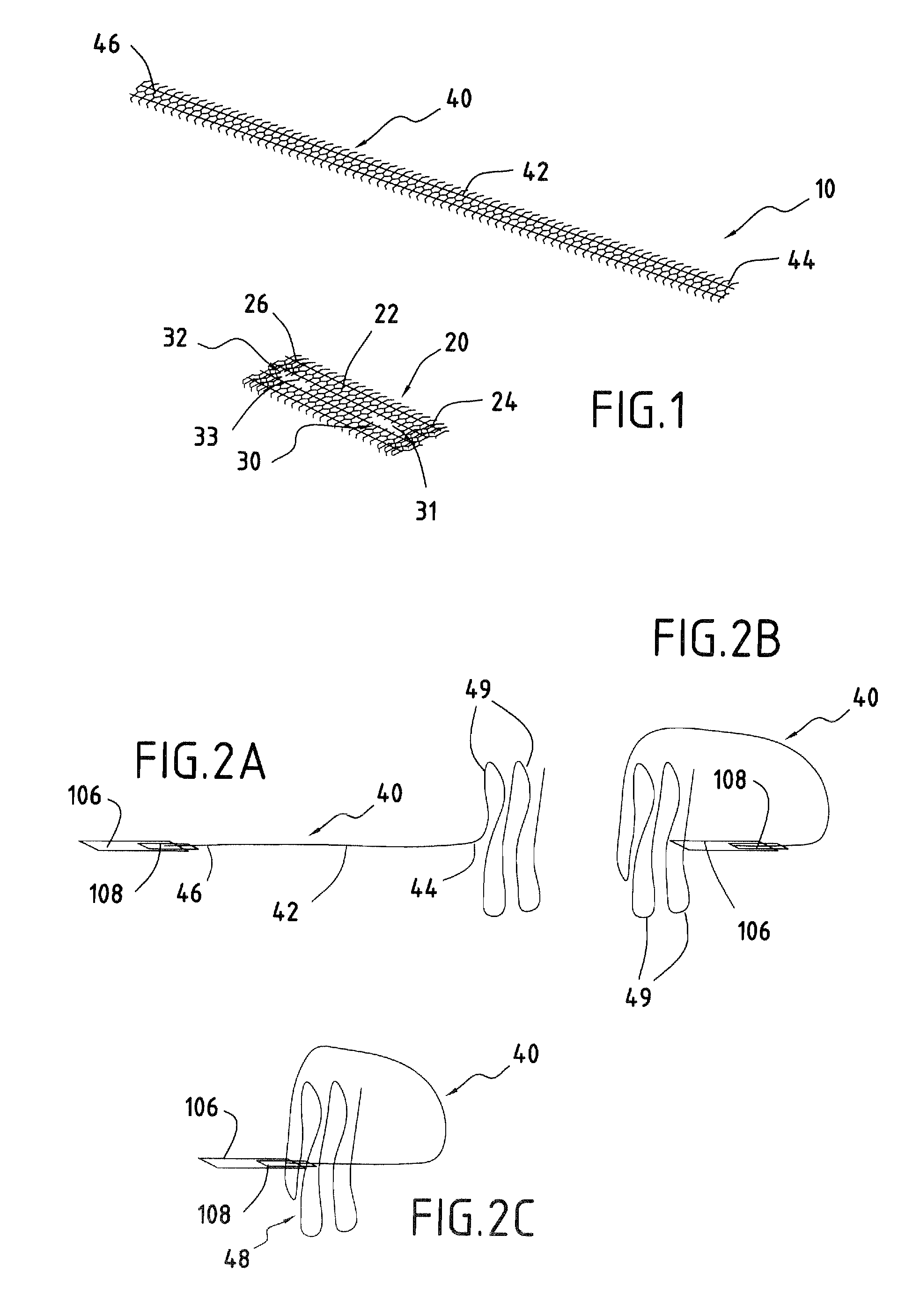 Surgical device forming a surgical prosthesis