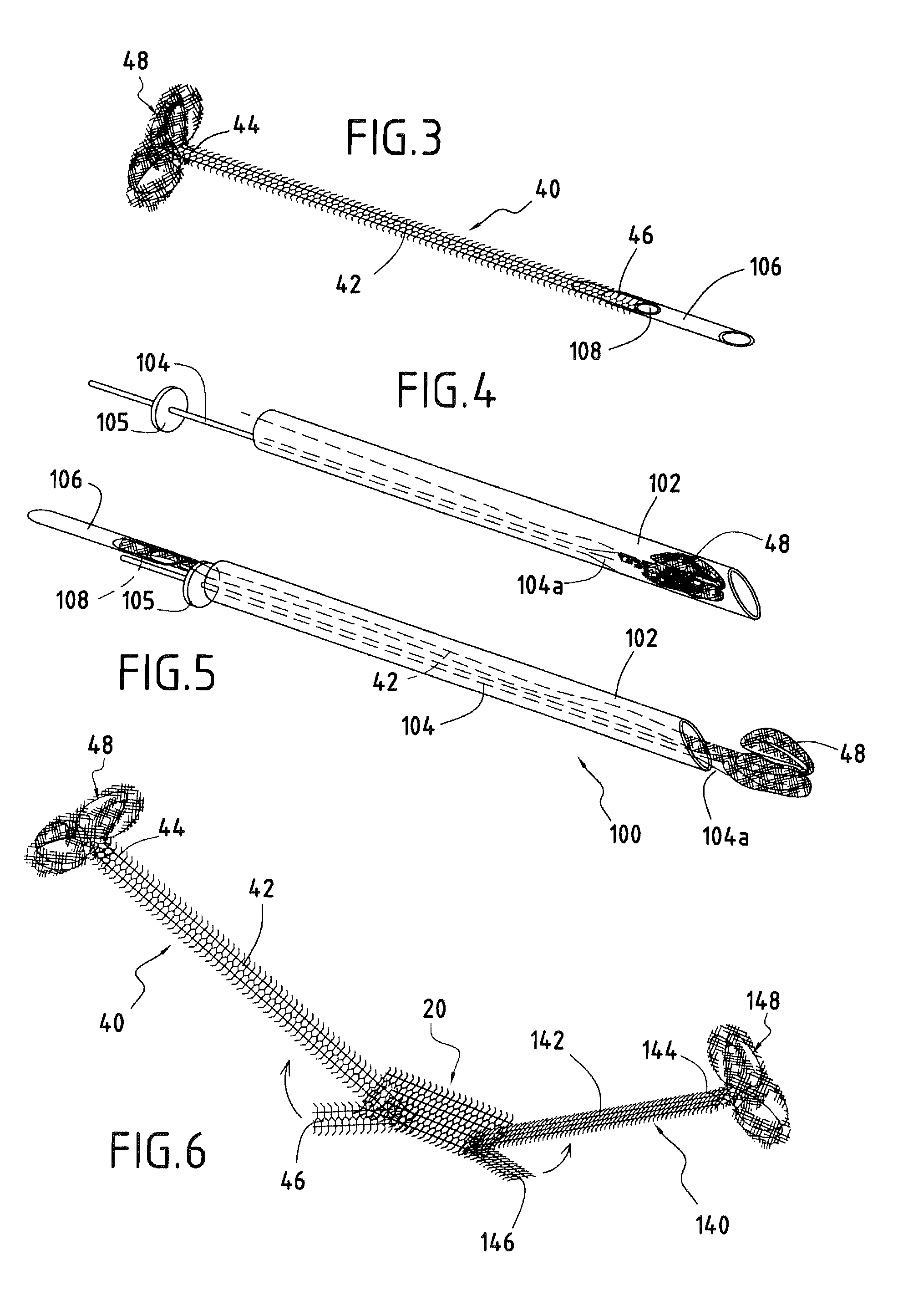 Surgical device forming a surgical prosthesis