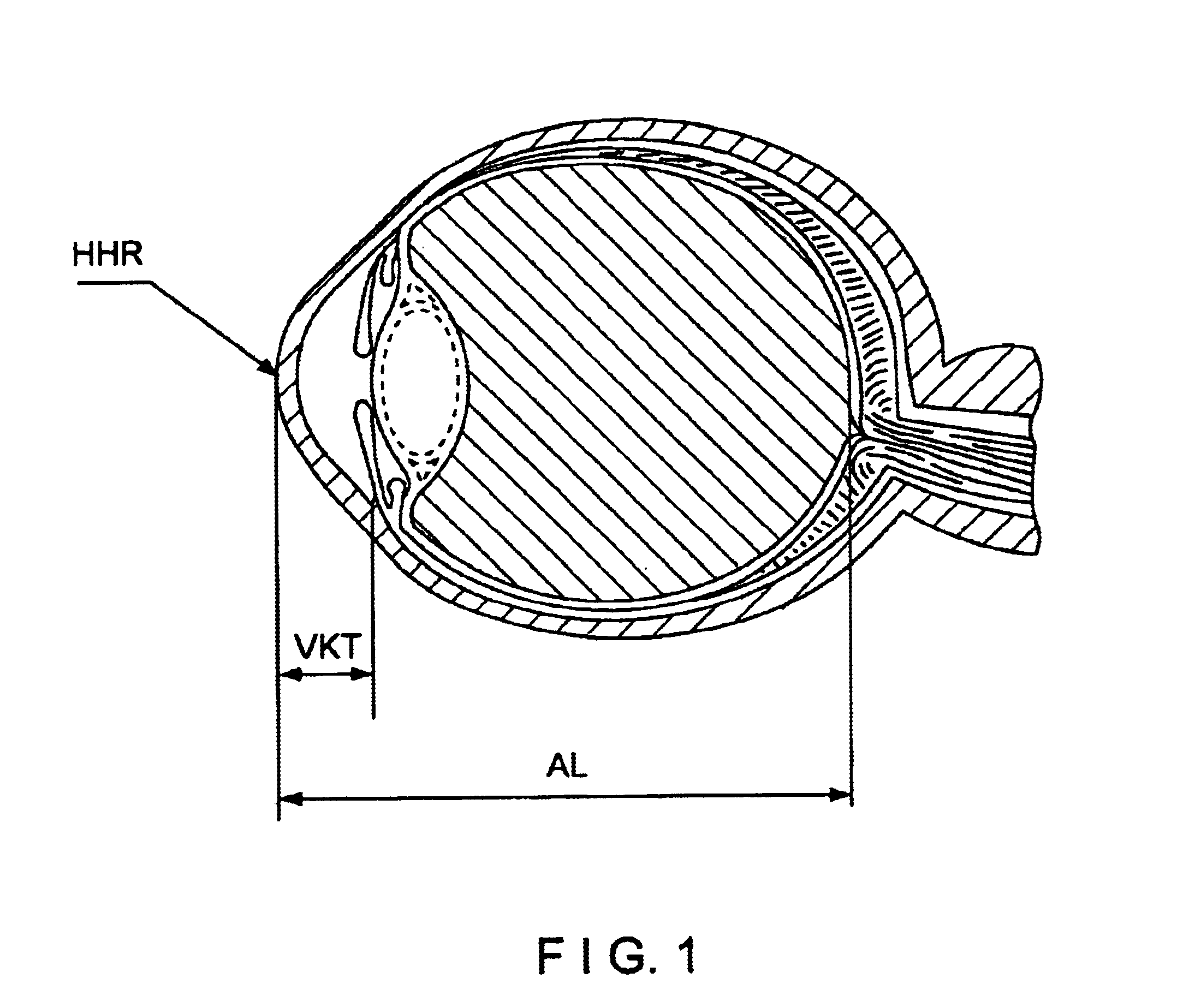 System and method for non-contacting measurement of the eye