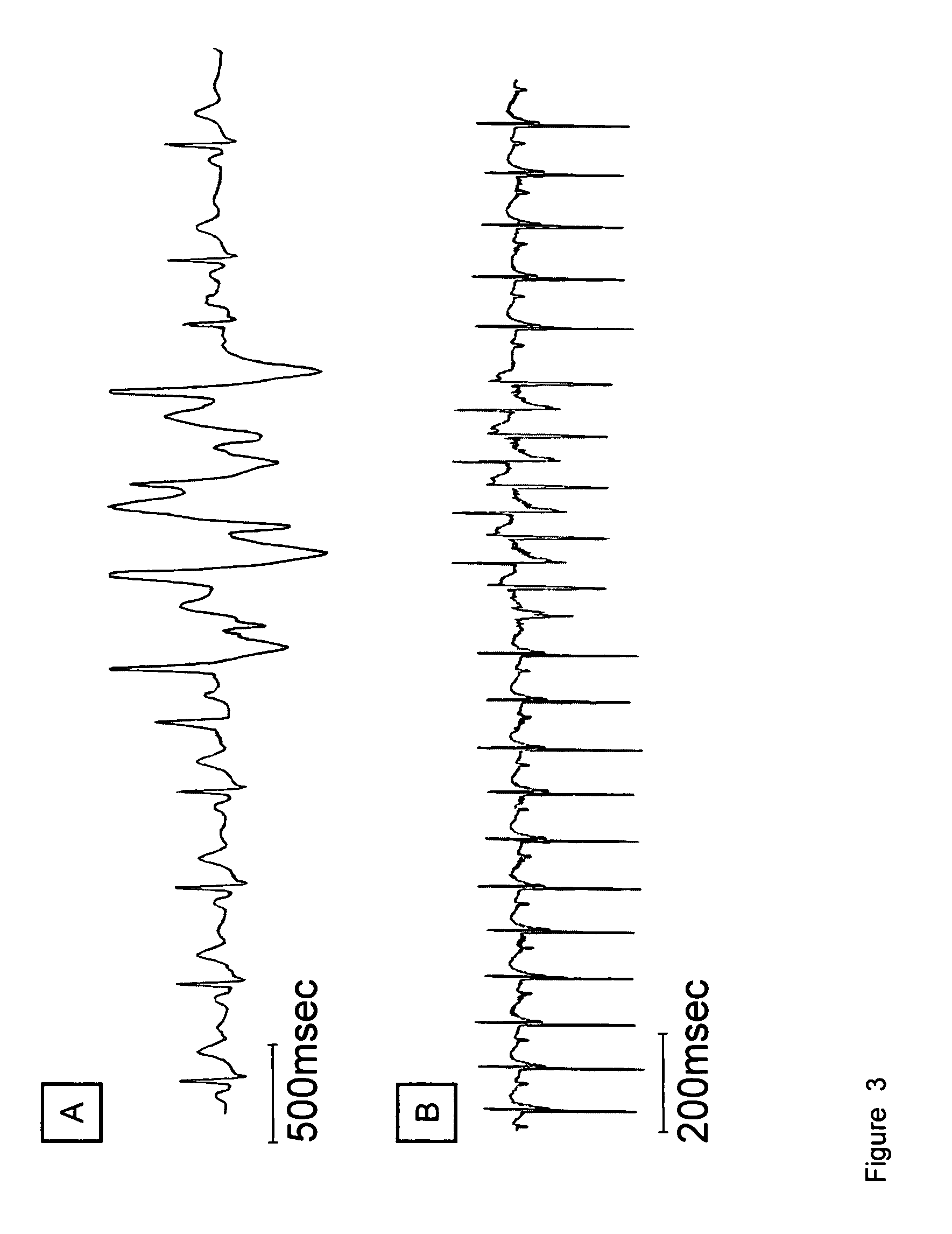 Transgenic animal model for catecholaminergic polymorphic ventricular tachycardia (CPVT) and use thereof