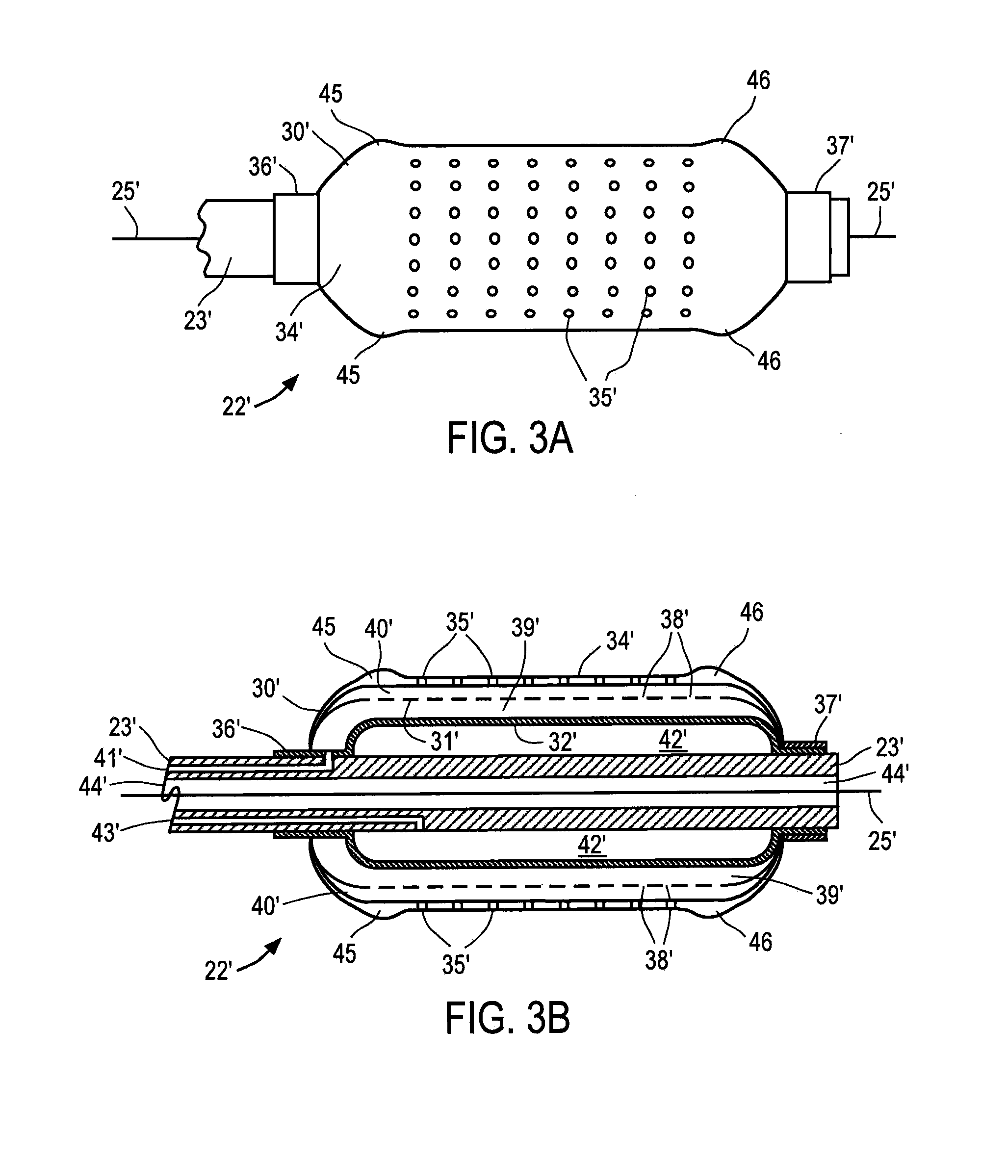 Apparatus and method for delivering intraluminal therapy