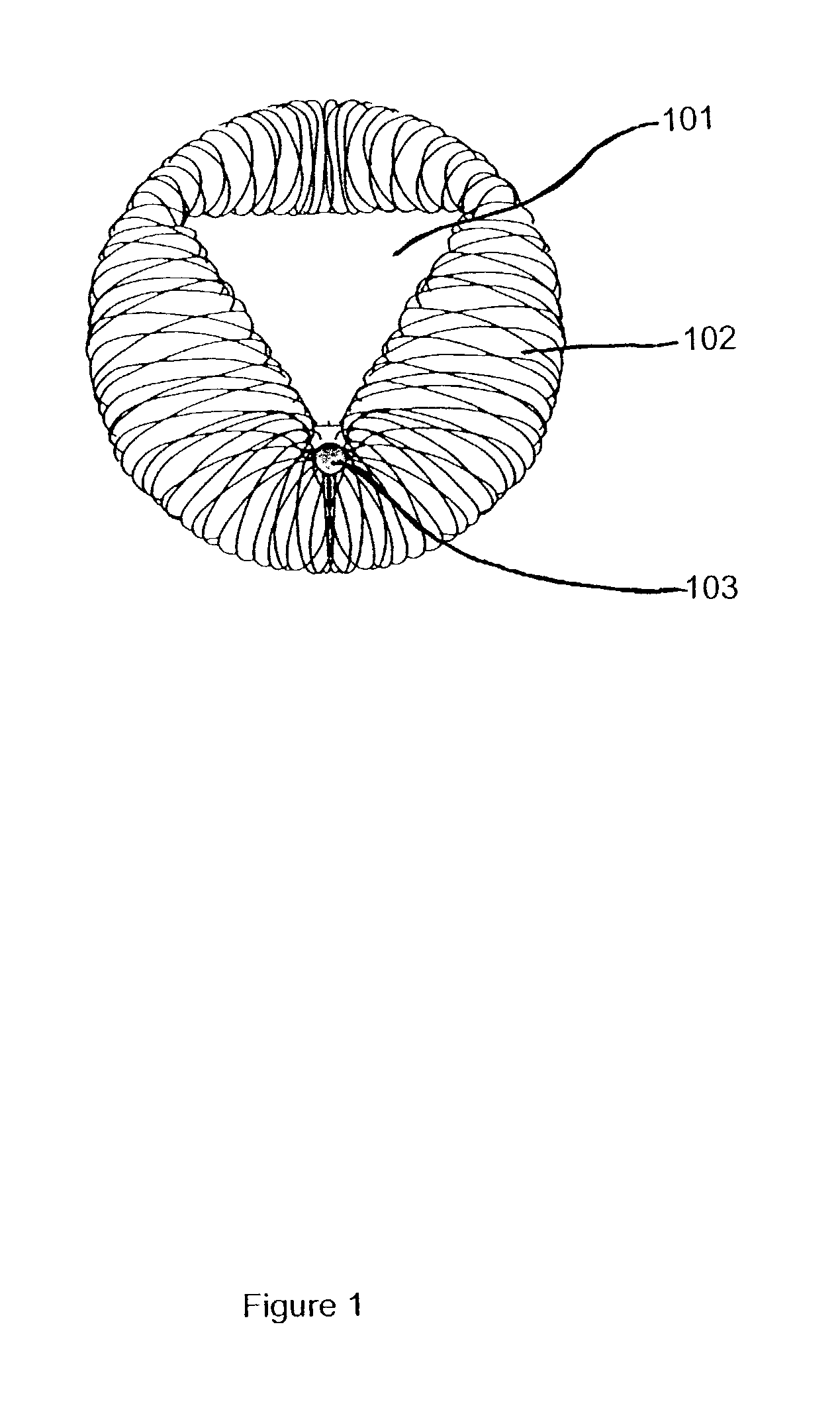Catheter deployed partial occlusion devices and methods