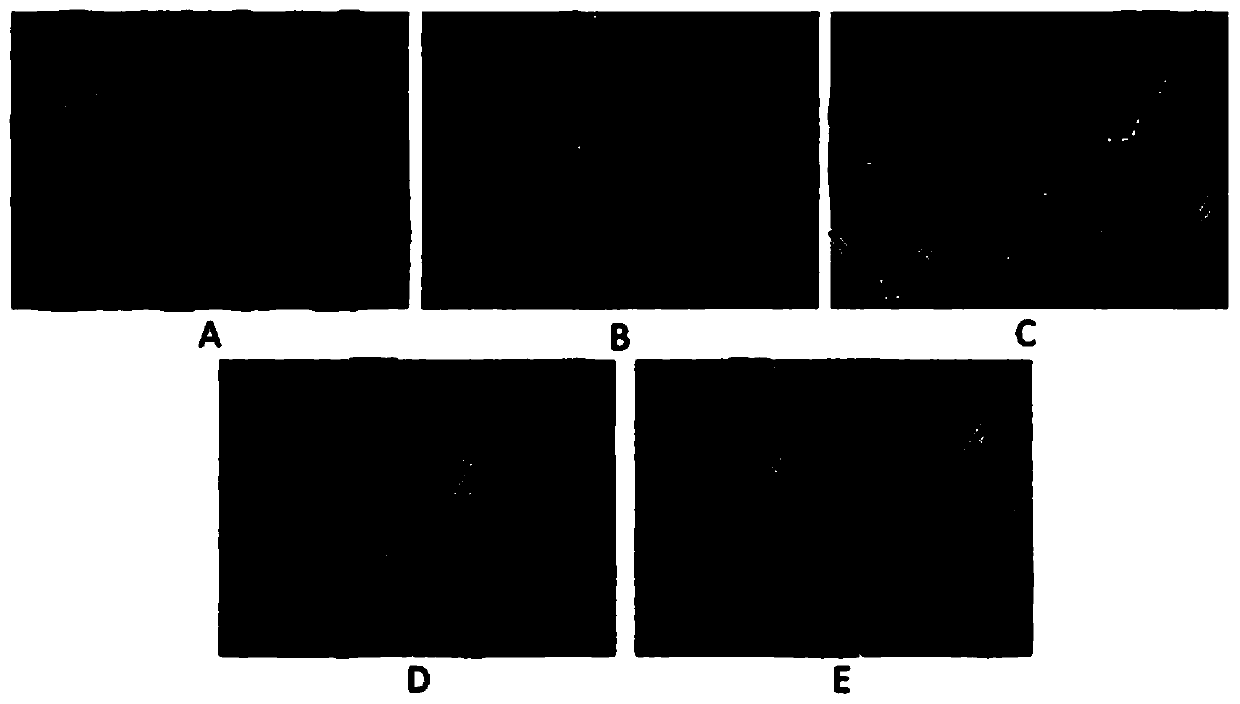 New application of astragalus polysaccharide in chromosome protection