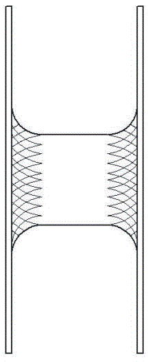 Single-layer knitted umbrella-shaped cardiac septum occluder