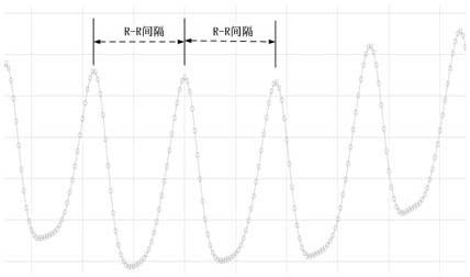 A Heart Monitoring Method Based on Pulse Rate Variability