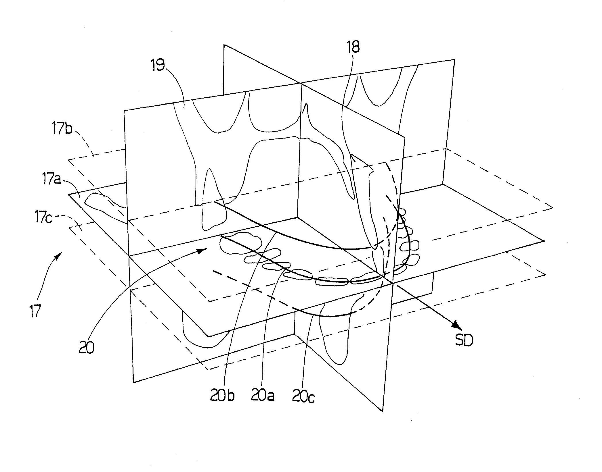 Method for the reconstruction of a panoramic image of an object, and a computed tomography scanner implementing said method