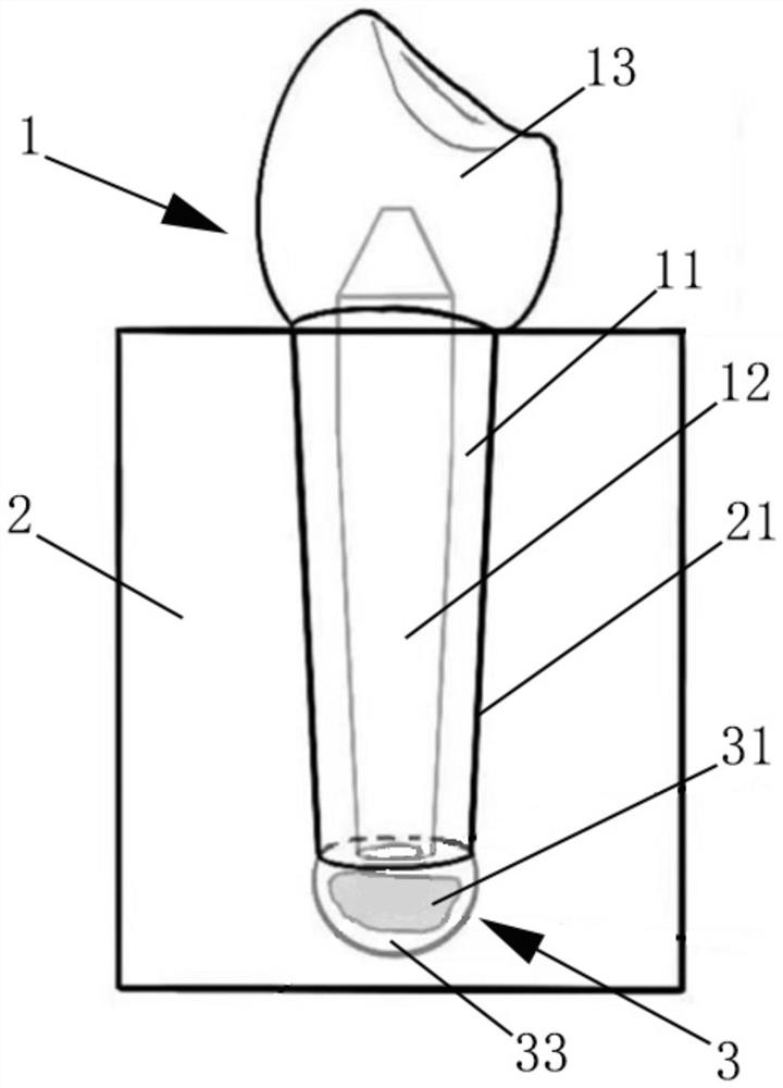 Diseased tooth model for simulating root canal barrier surgery in vitro as well as construction method and application of diseased tooth model