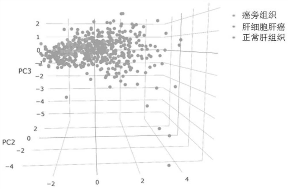 Application of biomarker in preparation or screening of liver cancer diagnostic reagent