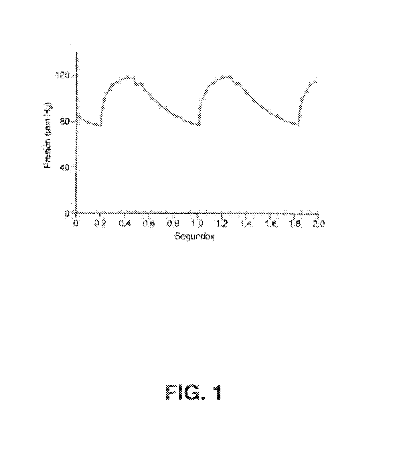 Methods and Systems for Non-Invasive Measurement of Blood Pressure