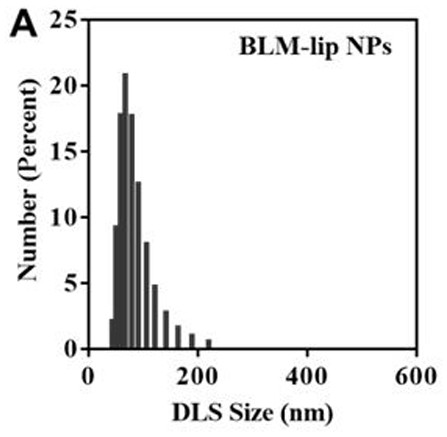 Targeted liposome drug delivery system and preparation method and application thereof