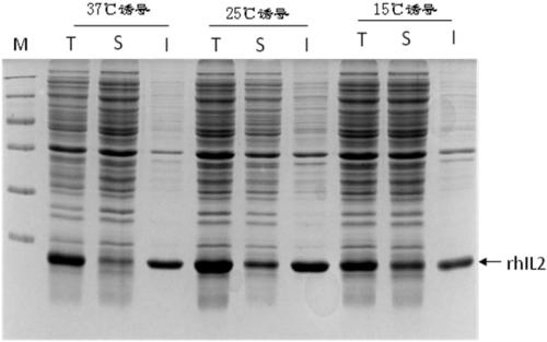 A method for optimizing the nucleotide sequence and efficient soluble expression of recombinant human interleukin-2
