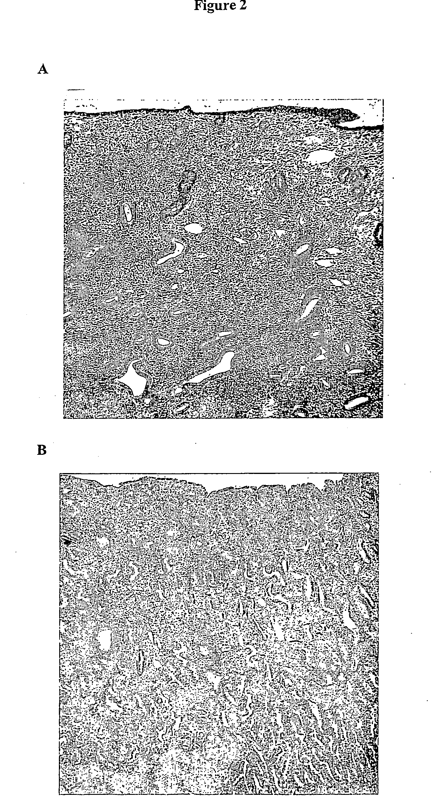 Methods For Detecting Markers Associated With Endometrial Disease or Phase