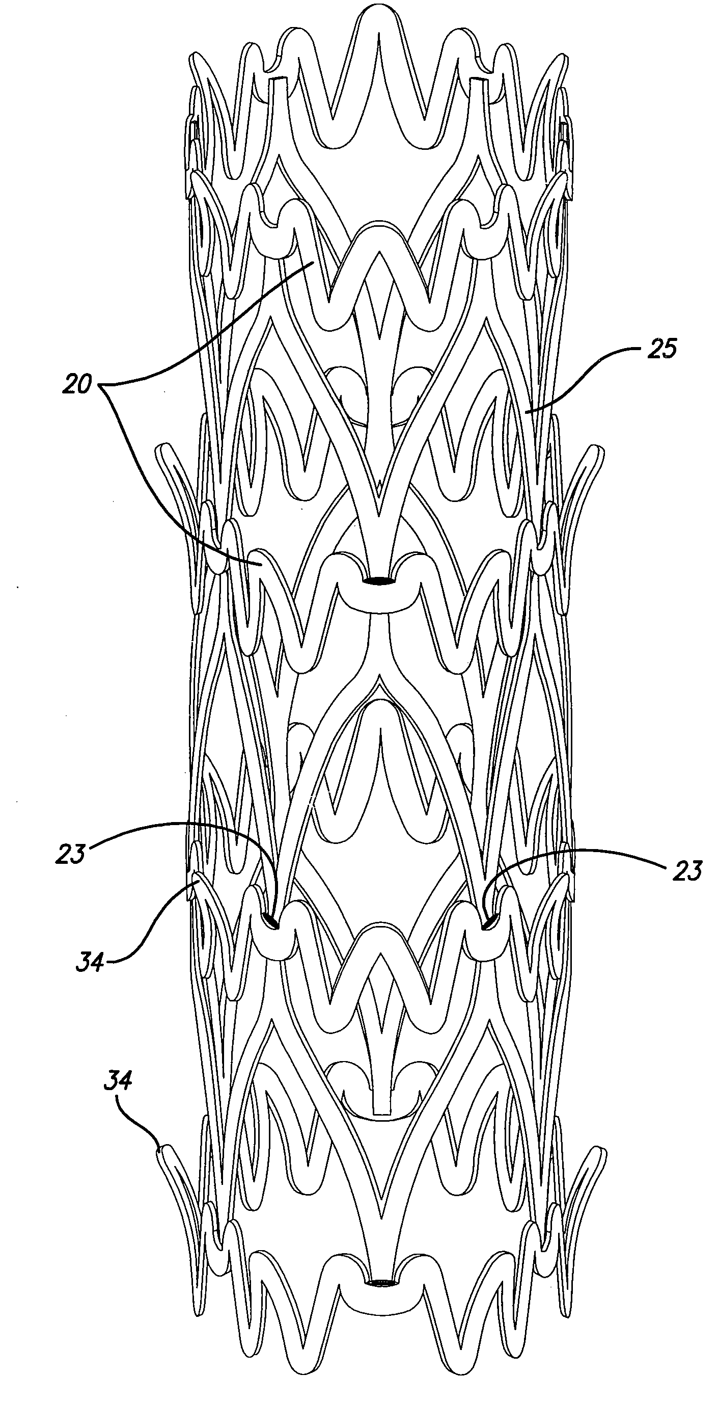 Hybrid stent and method of making