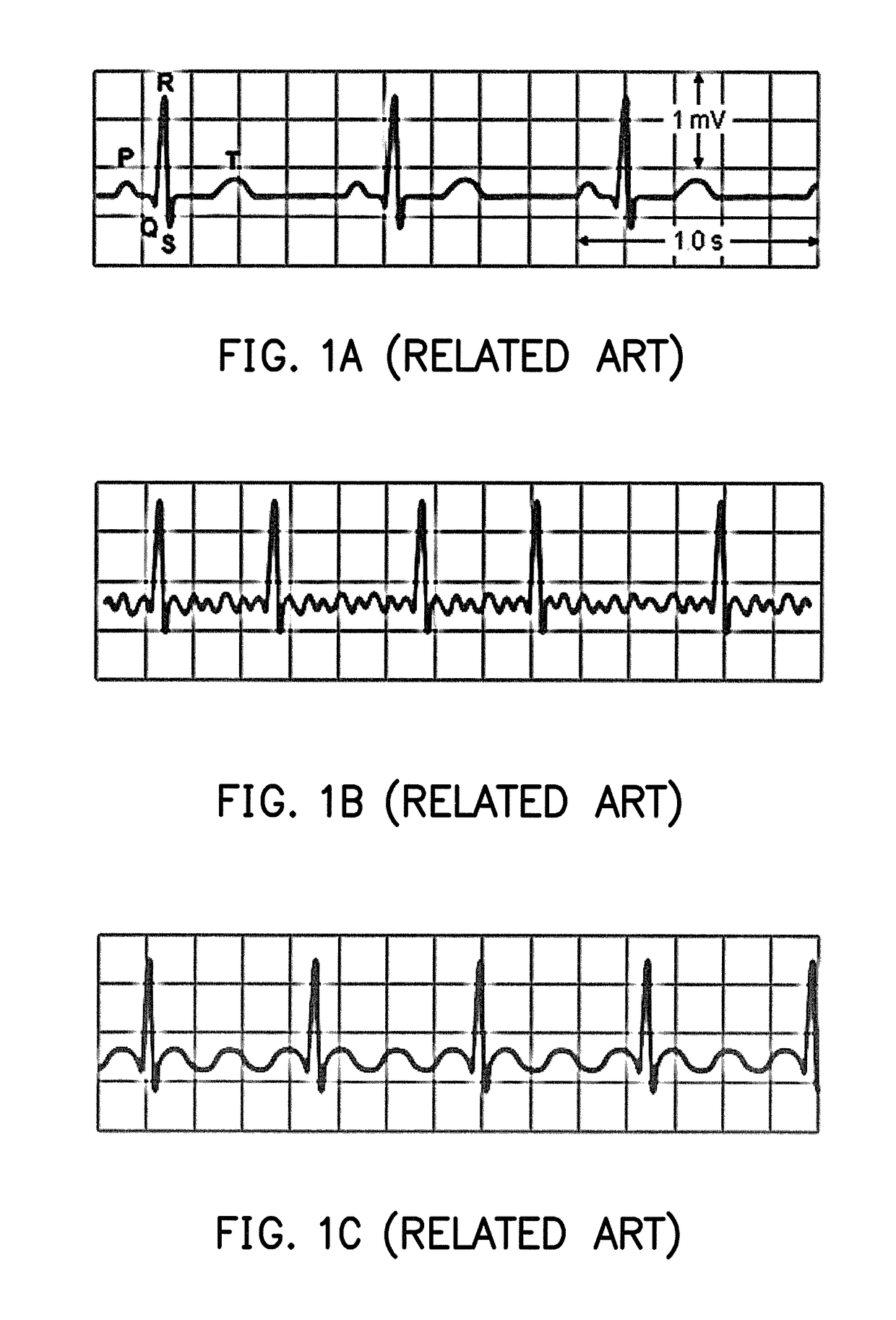 Method, electronic apparatus, and computer readable medium of constructing classifier for disease detection