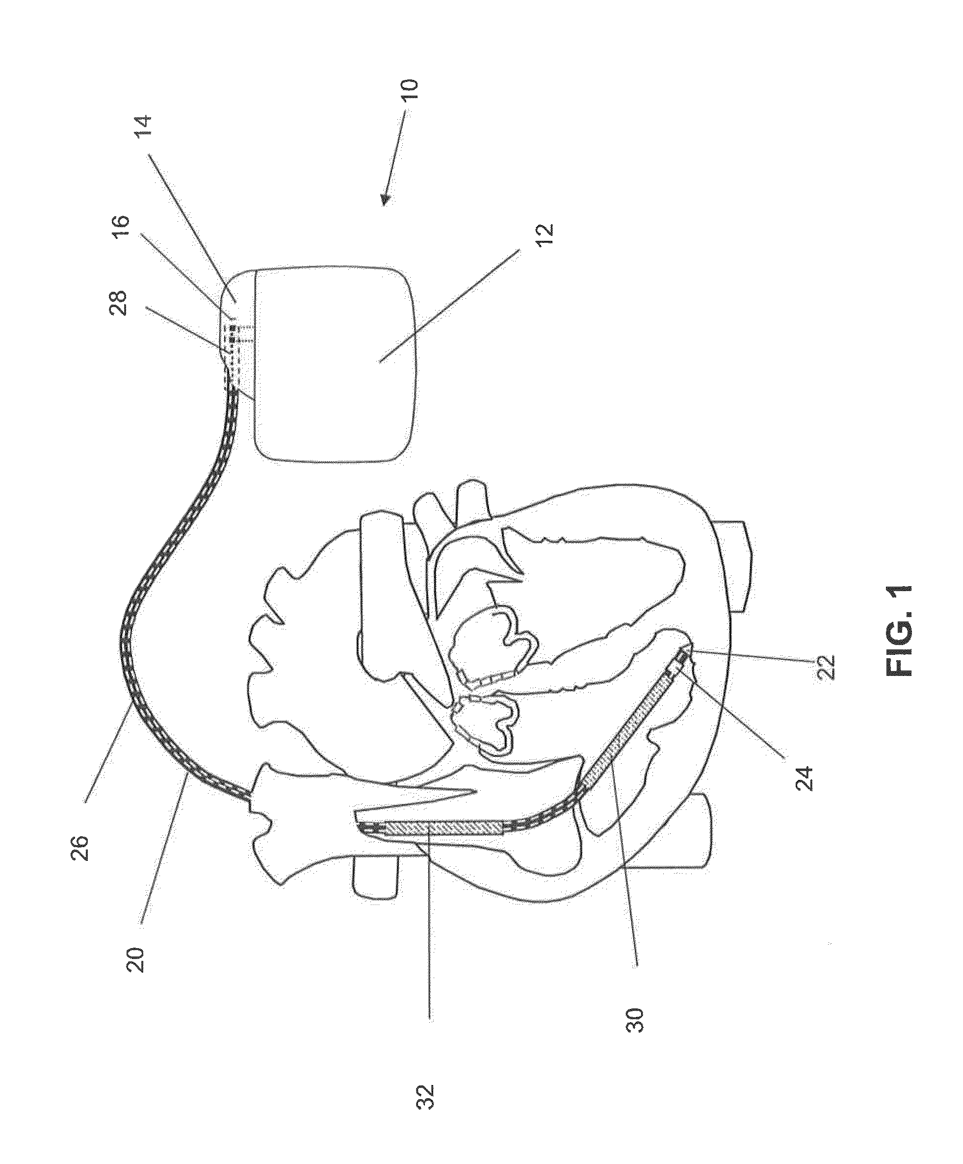 Implantable device with electrical filter