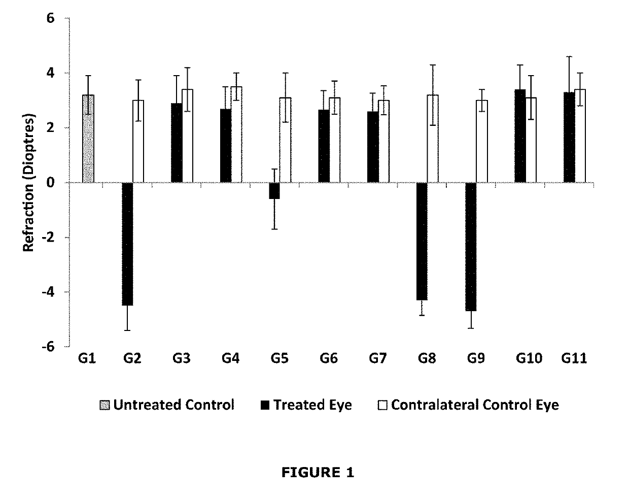 Ophthalmic compositions comprising levodopa, an antioxidant and an aqueous carrier