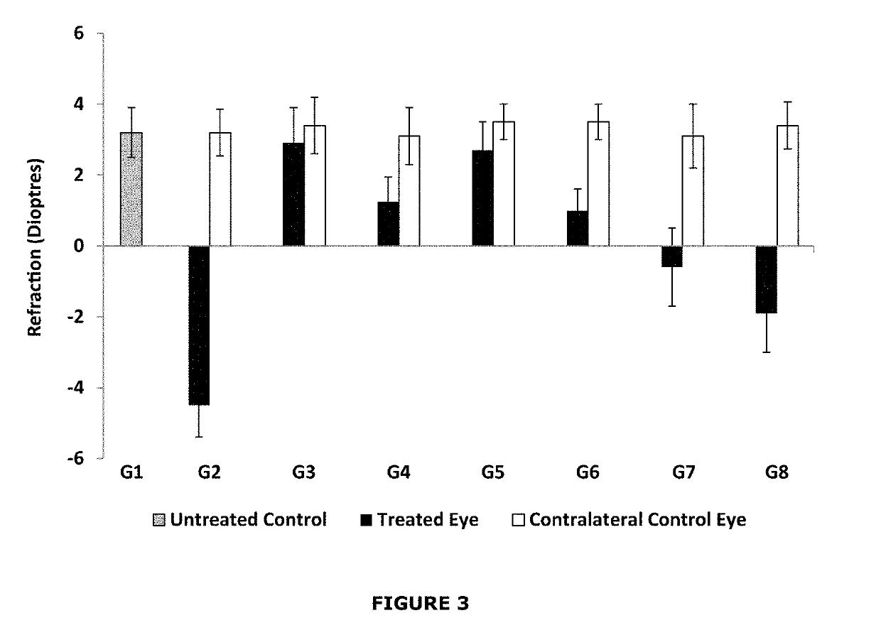 Ophthalmic compositions comprising levodopa, an antioxidant and an aqueous carrier