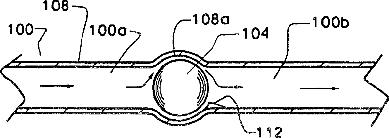 Apparatus and method for preventing free flow in an infusion line