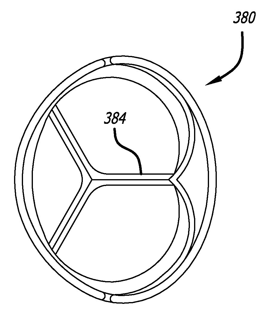 Heart valve assembly systems and methods