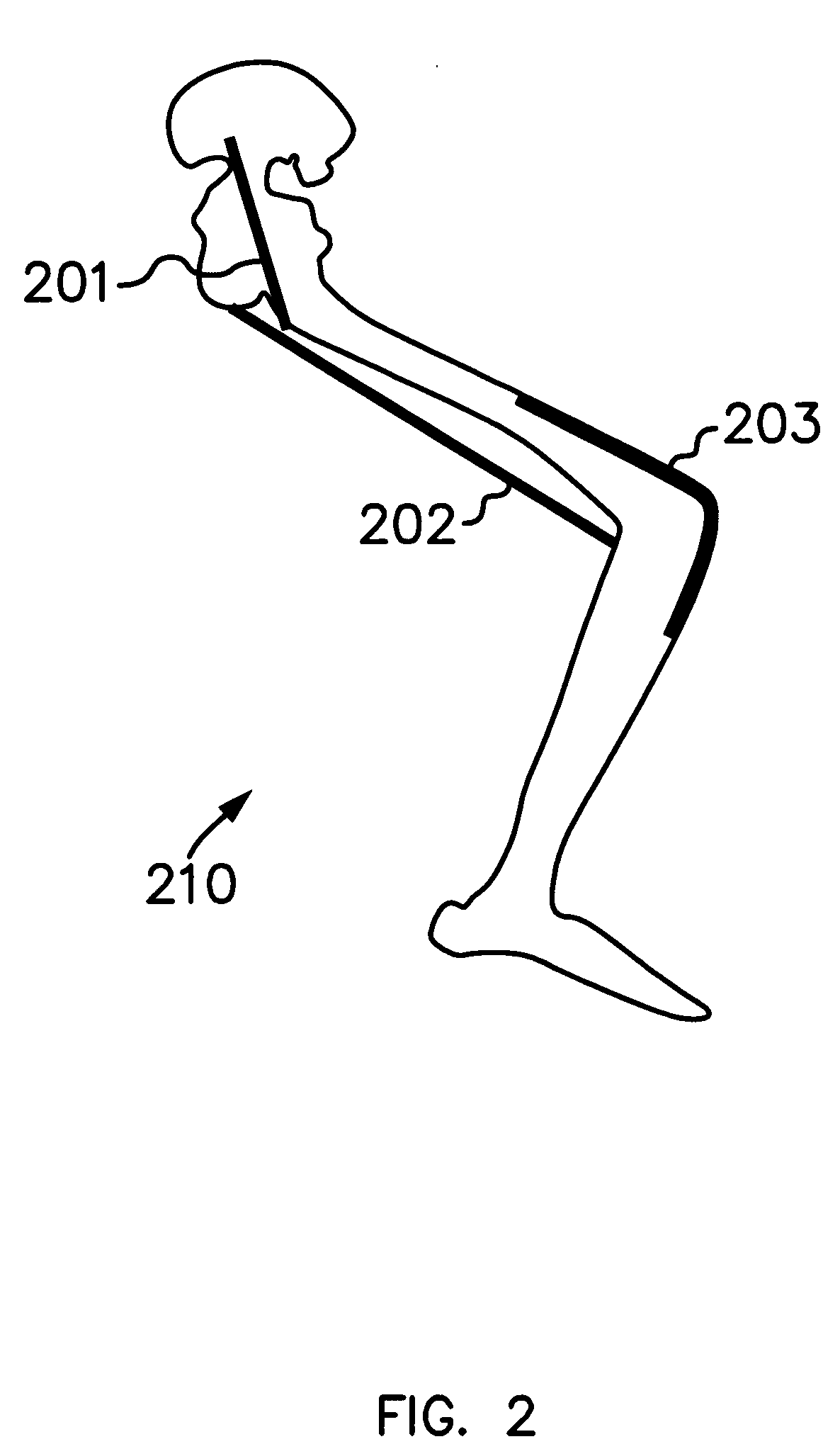 System for functional electrical stimulation