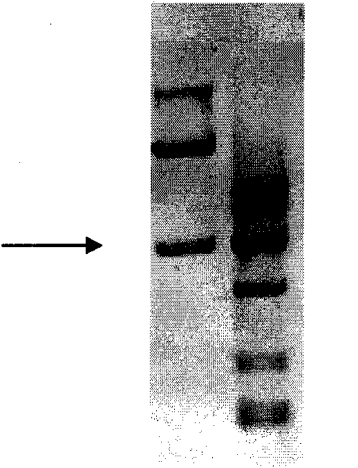 Method for expressing and producing recombinant human blood coagulation factors VII in animal cells