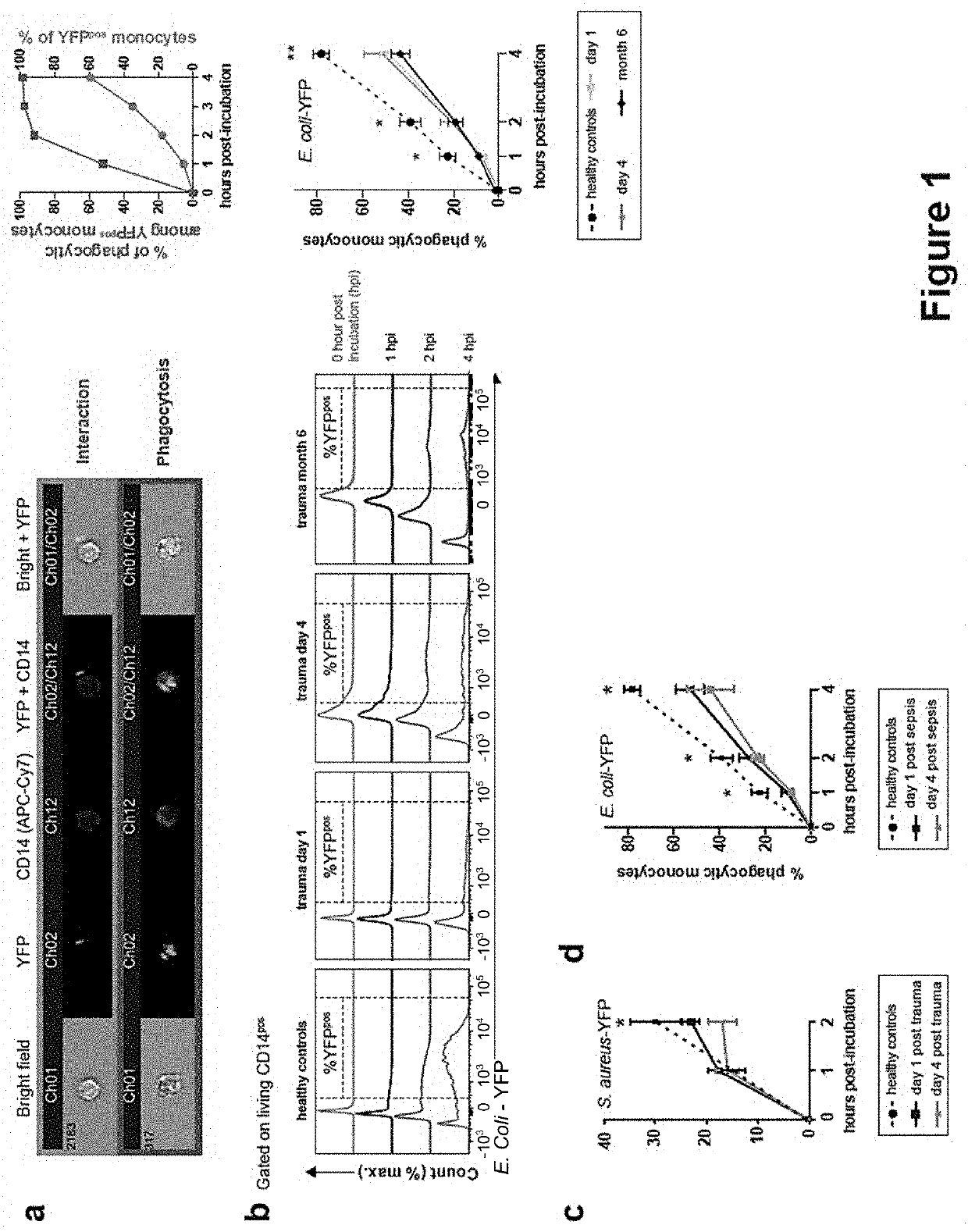 Inhibitor of surface protein (sp-d) / sirpa / shp2 pathway for use in the prevention and/or treatment of secondary infection