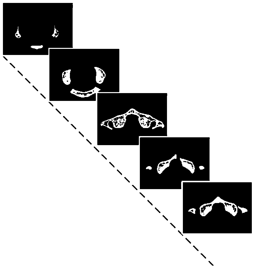 A Mesh Model Adaptive Reconstruction Method for Skeleton CT Sequence Images