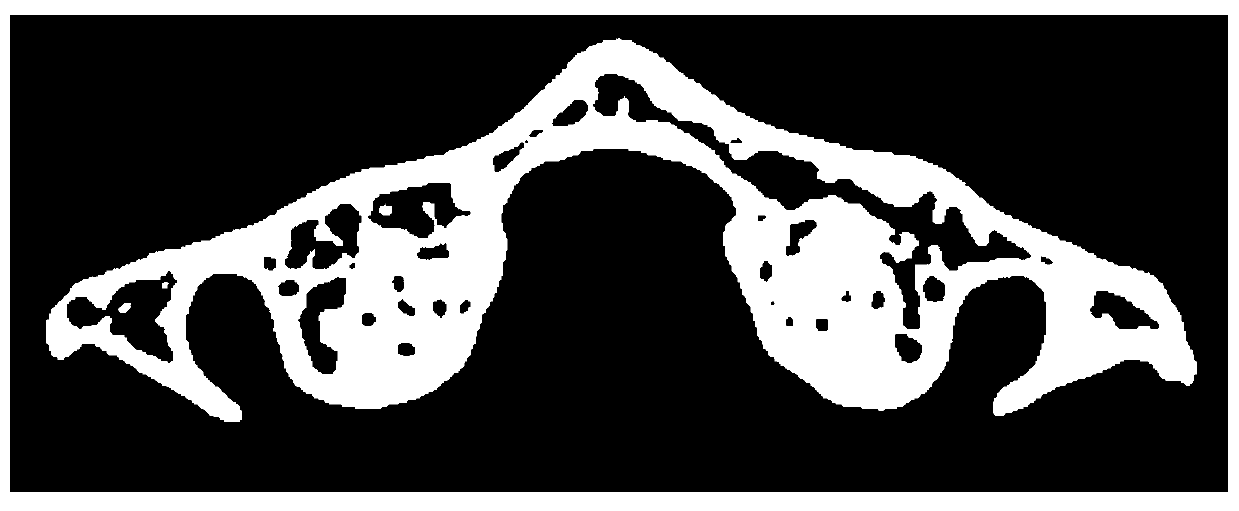 A Mesh Model Adaptive Reconstruction Method for Skeleton CT Sequence Images