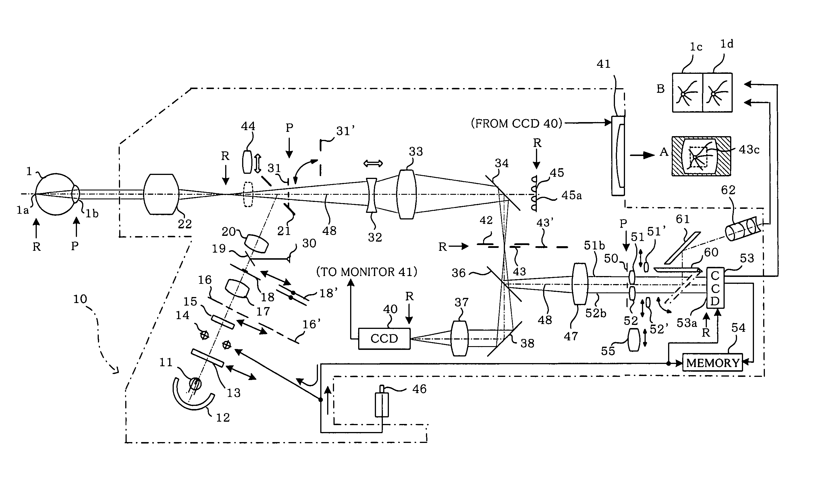 Ophthalmologic photography apparatus