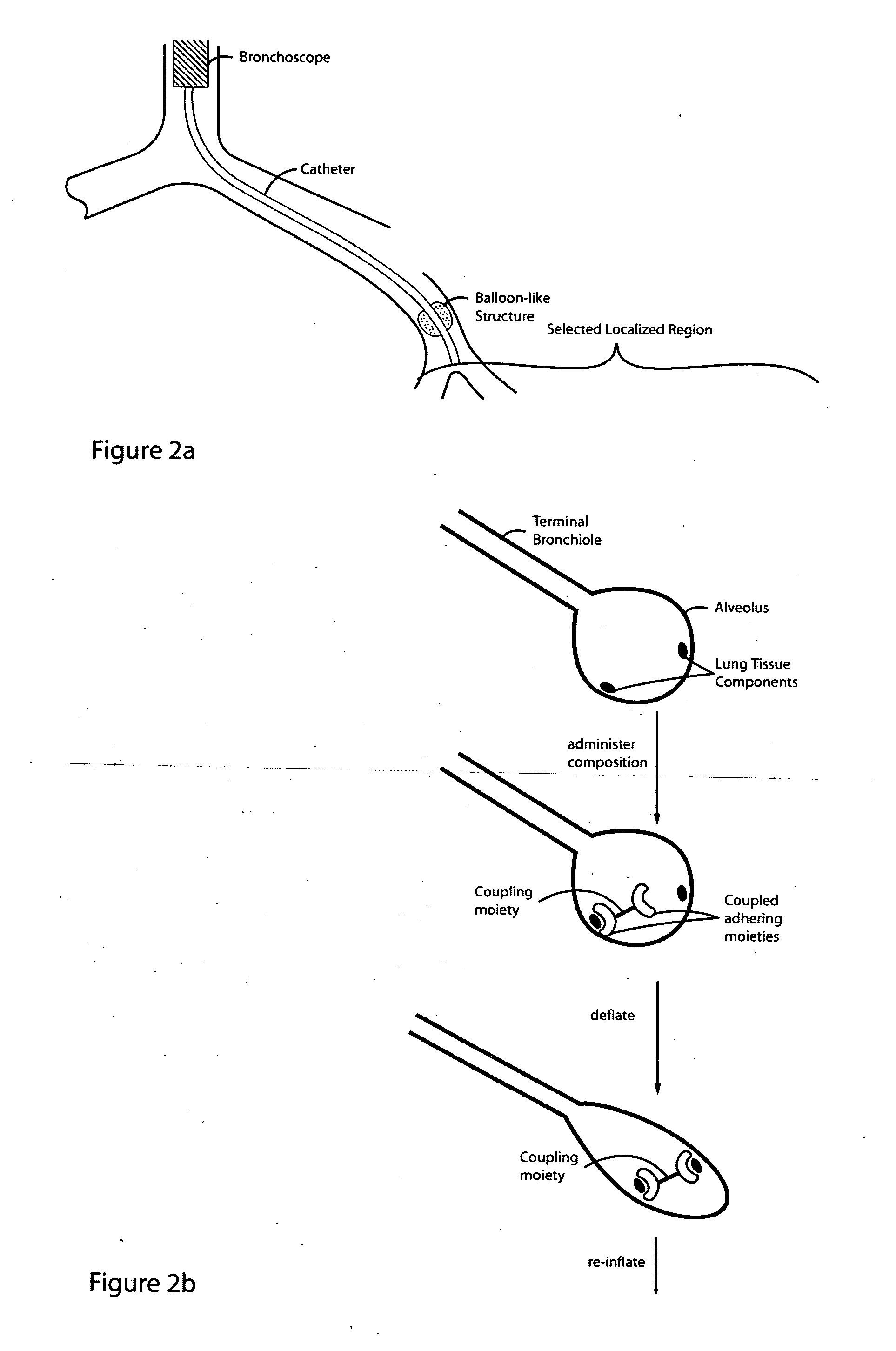 Lung volume reduction using glue compositions